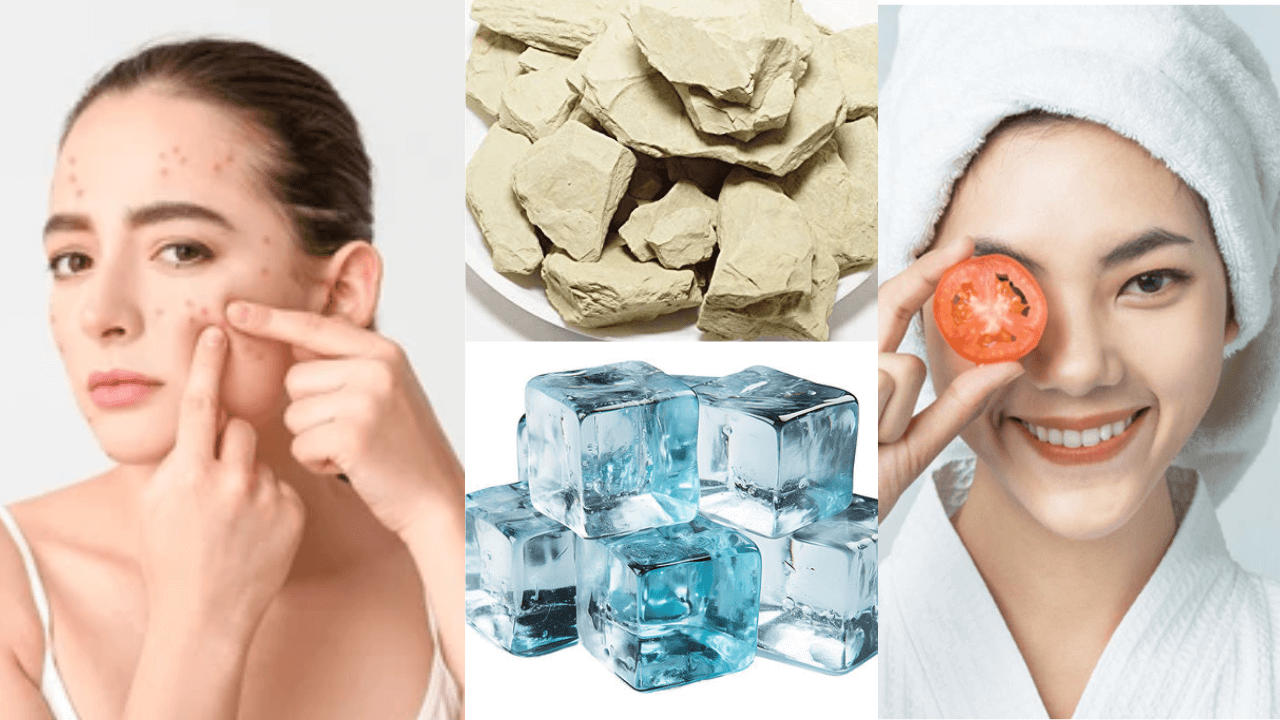 How to get rid pimple fast hindi